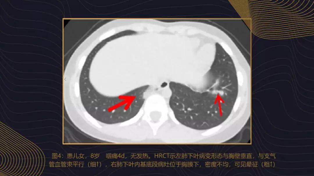 江西新冠肺炎最新通告